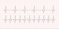 Cardiogram, heartbeat. Electrocardiogram